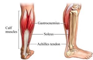 Achilles Pain Achilles Tendinopathy Treatment Carina